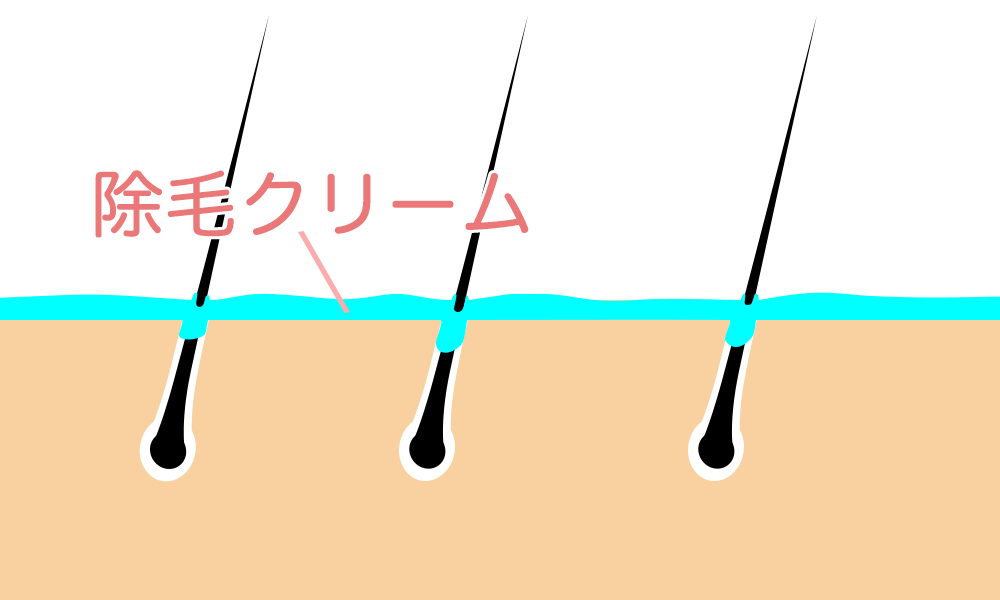 除毛クリーム